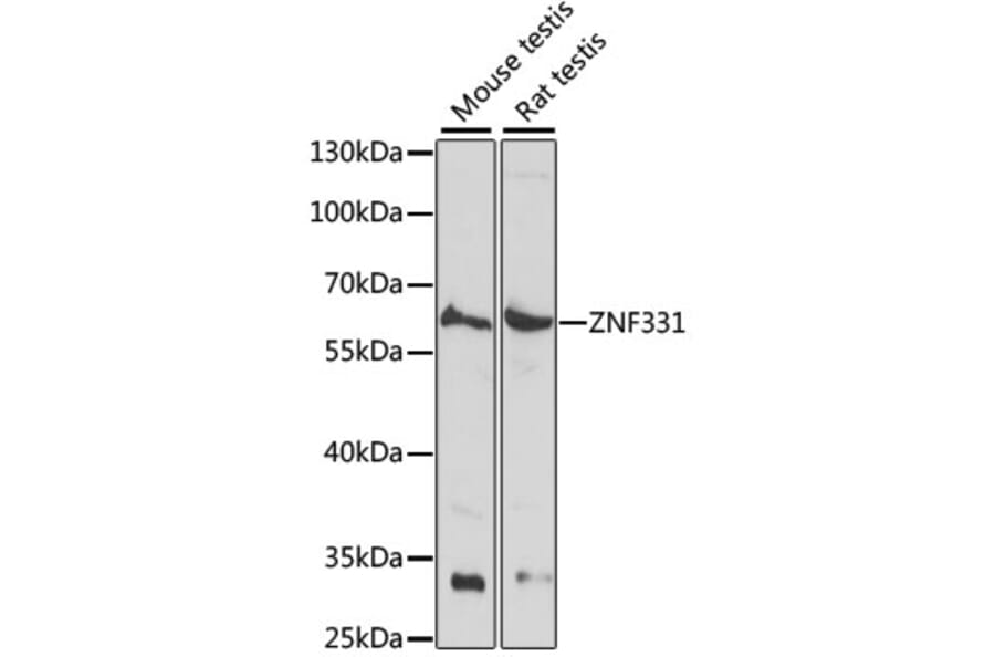 Western Blot - Anti-ZNF331 Antibody (A90562) - Antibodies.com
