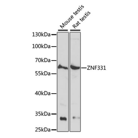 Western Blot - Anti-ZNF331 Antibody (A90562) - Antibodies.com