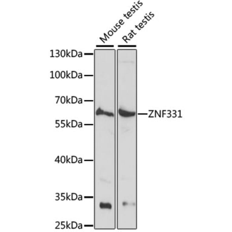 Western Blot - Anti-ZNF331 Antibody (A90562) - Antibodies.com