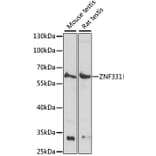 Western Blot - Anti-ZNF331 Antibody (A90562) - Antibodies.com