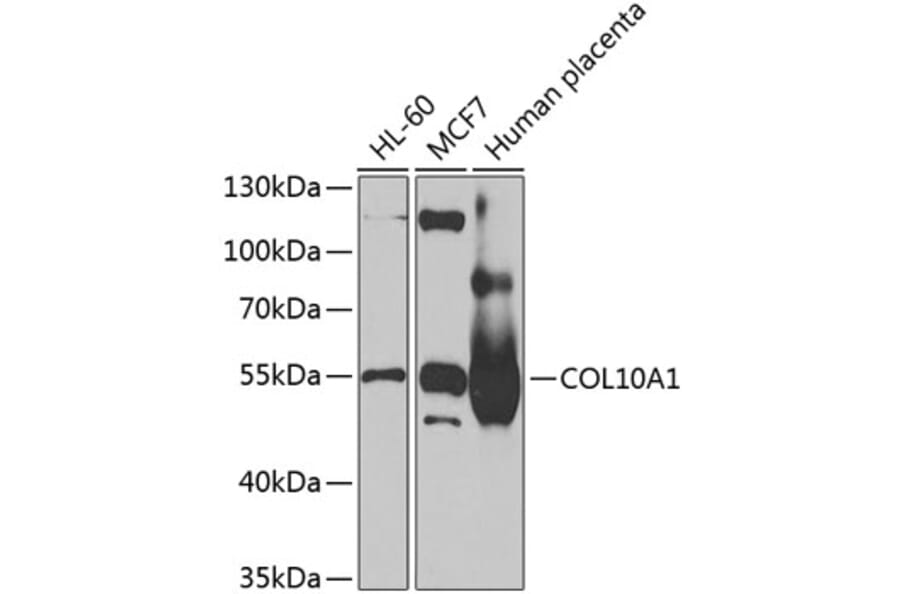 Western Blot - Anti-COL10A1 Antibody (A13288) - Antibodies.com