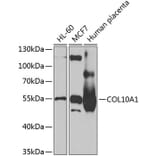 Western Blot - Anti-COL10A1 Antibody (A13288) - Antibodies.com