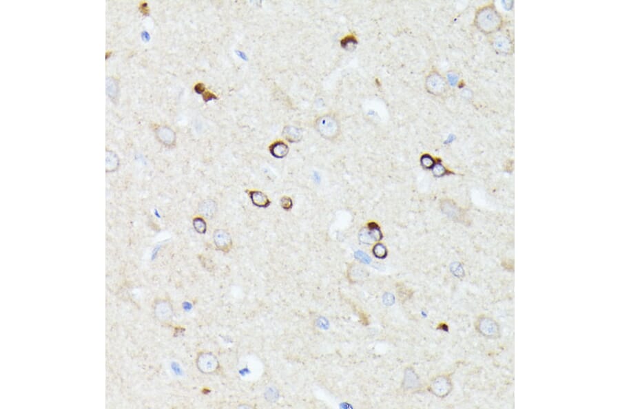 Immunohistochemistry - Anti-CCDC6 Antibody (A90564) - Antibodies.com