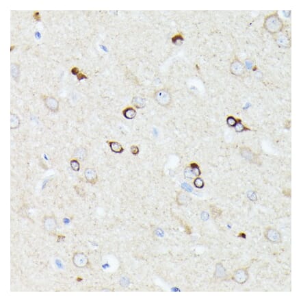 Immunohistochemistry - Anti-CCDC6 Antibody (A90564) - Antibodies.com