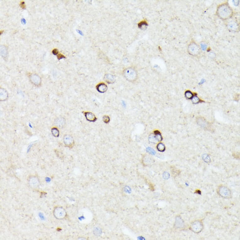 Immunohistochemistry - Anti-CCDC6 Antibody (A90564) - Antibodies.com