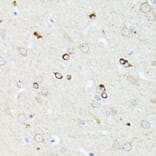 Immunohistochemistry - Anti-CCDC6 Antibody (A90564) - Antibodies.com