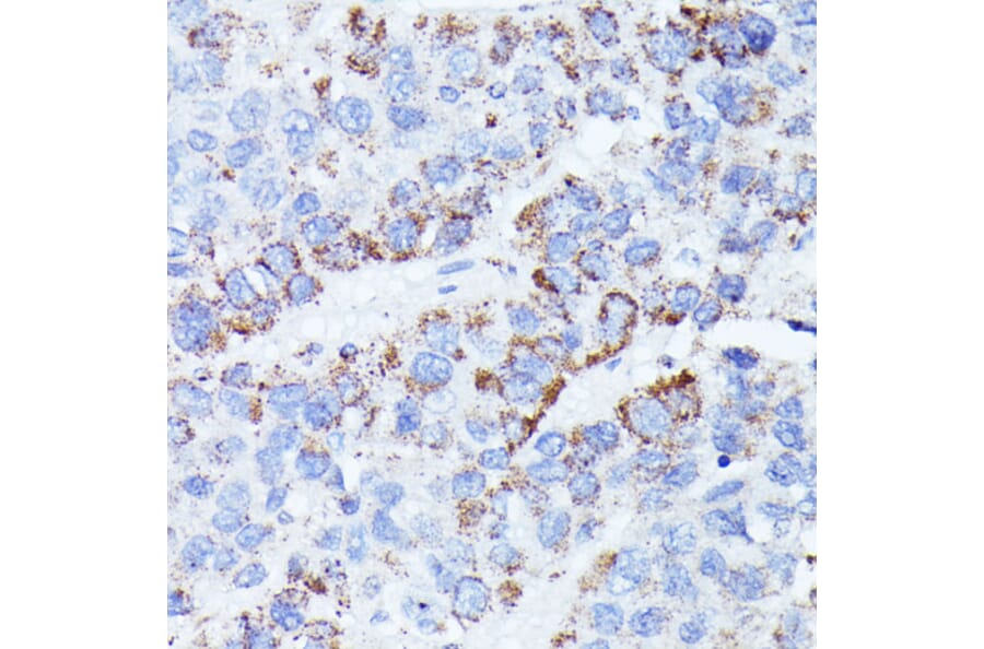 Immunohistochemistry - Anti-CCDC6 Antibody (A90564) - Antibodies.com