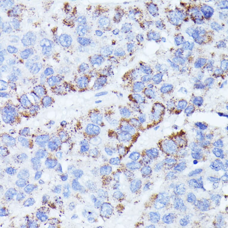 Immunohistochemistry - Anti-CCDC6 Antibody (A90564) - Antibodies.com