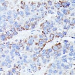 Immunohistochemistry - Anti-CCDC6 Antibody (A90564) - Antibodies.com