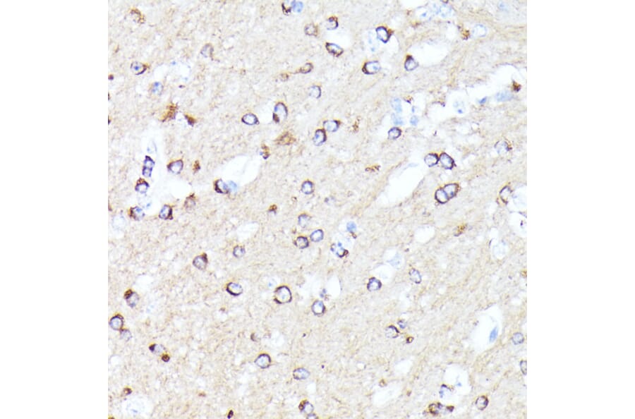 Immunohistochemistry - Anti-CCDC6 Antibody (A90564) - Antibodies.com