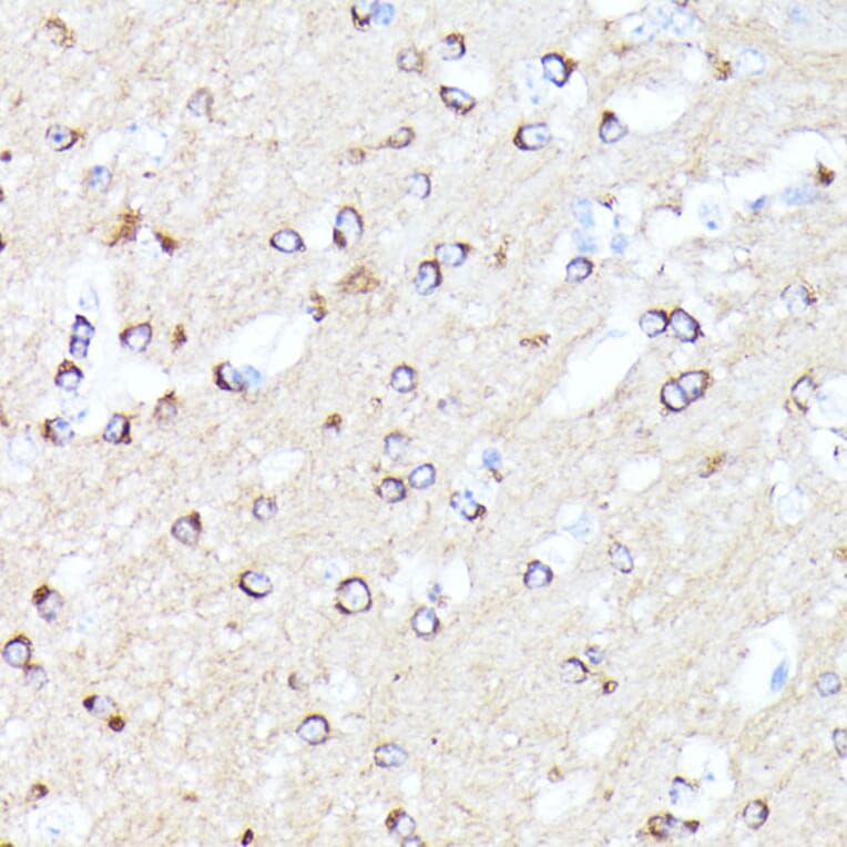 Immunohistochemistry - Anti-CCDC6 Antibody (A90564) - Antibodies.com