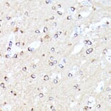 Immunohistochemistry - Anti-CCDC6 Antibody (A90564) - Antibodies.com