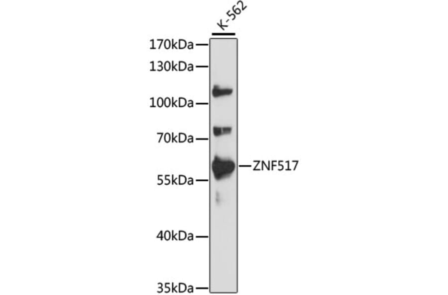 Western Blot - Anti-ZNF517 Antibody (A90565) - Antibodies.com