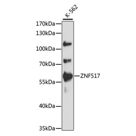 Western Blot - Anti-ZNF517 Antibody (A90565) - Antibodies.com