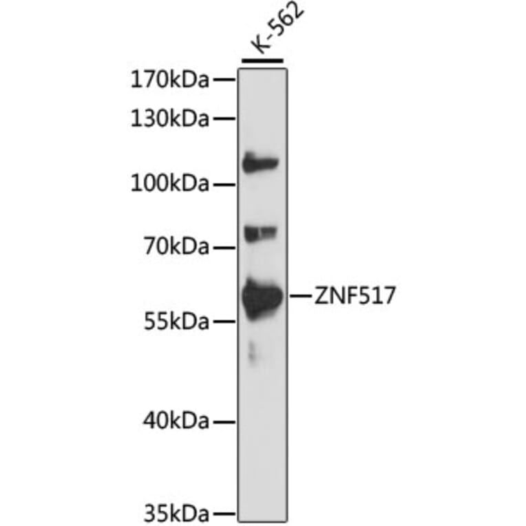 Western Blot - Anti-ZNF517 Antibody (A90565) - Antibodies.com