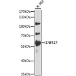 Western Blot - Anti-ZNF517 Antibody (A90565) - Antibodies.com