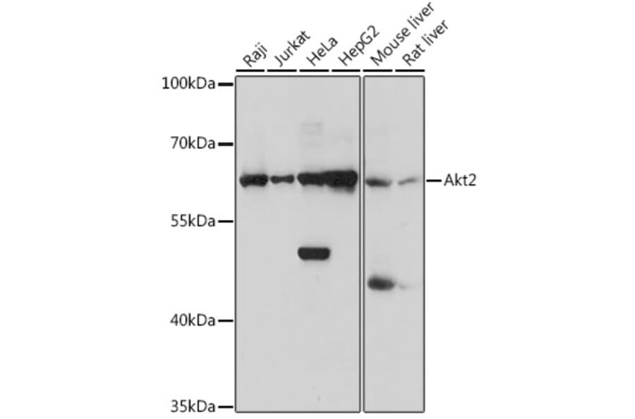 Western Blot - Anti-AKT2 Antibody (A90566) - Antibodies.com