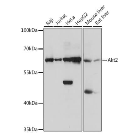 Western Blot - Anti-AKT2 Antibody (A90566) - Antibodies.com