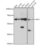 Western Blot - Anti-AKT2 Antibody (A90566) - Antibodies.com