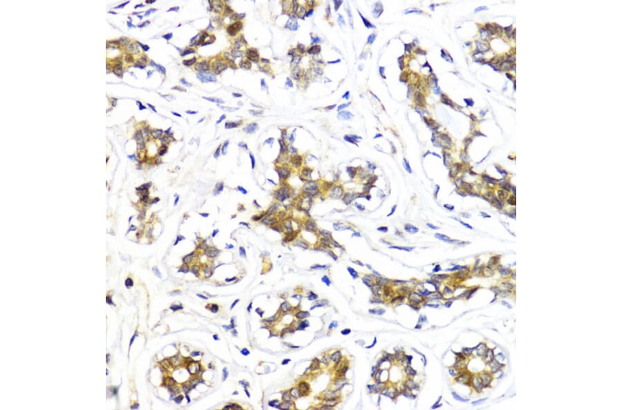 Immunohistochemistry - Anti-AKT2 Antibody (A90566) - Antibodies.com