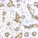 Immunohistochemistry - Anti-AKT2 Antibody (A90566) - Antibodies.com