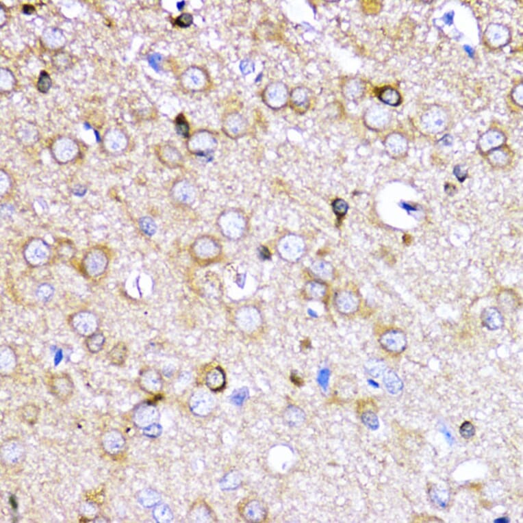 Immunohistochemistry - Anti-AKT2 Antibody (A90566) - Antibodies.com