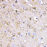 Immunohistochemistry - Anti-AKT2 Antibody (A90566) - Antibodies.com