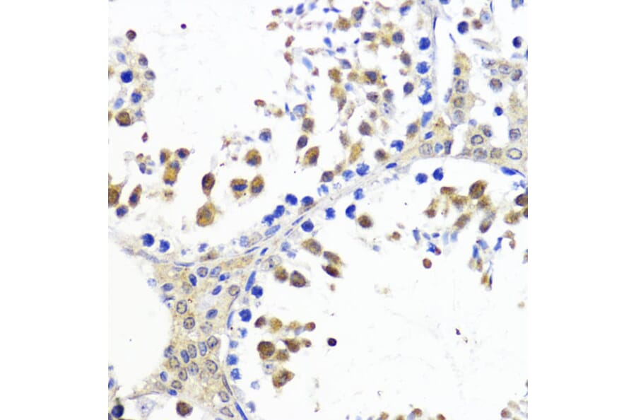 Immunohistochemistry - Anti-AKT2 Antibody (A90566) - Antibodies.com