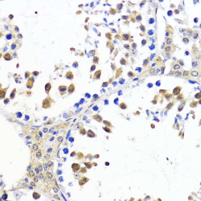 Immunohistochemistry - Anti-AKT2 Antibody (A90566) - Antibodies.com