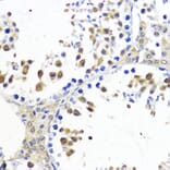 Immunohistochemistry - Anti-AKT2 Antibody (A90566) - Antibodies.com