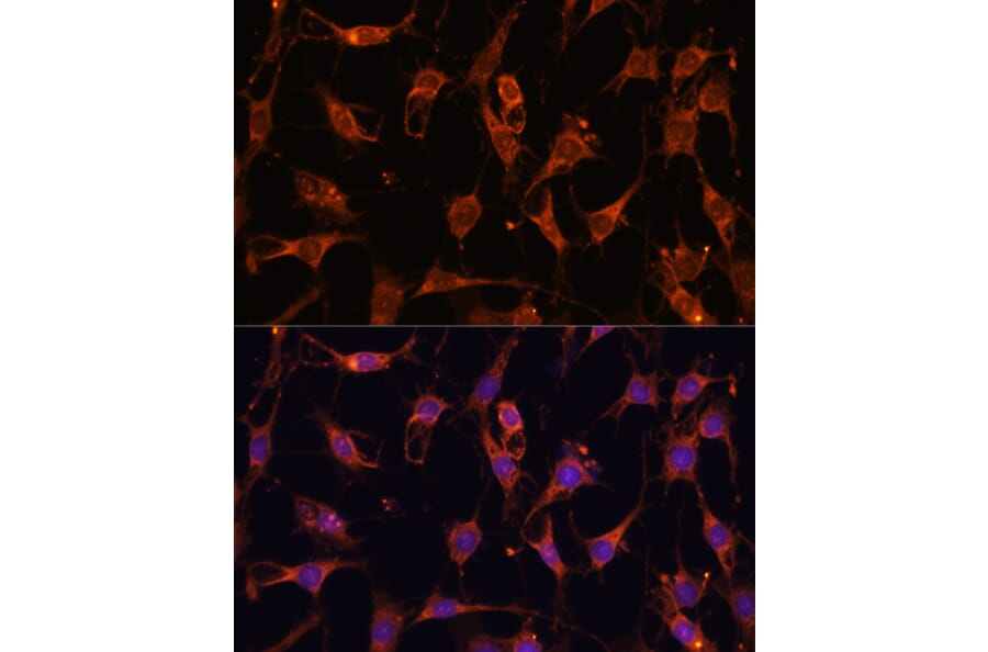 Immunofluorescence - Anti-AKT2 Antibody (A90566) - Antibodies.com