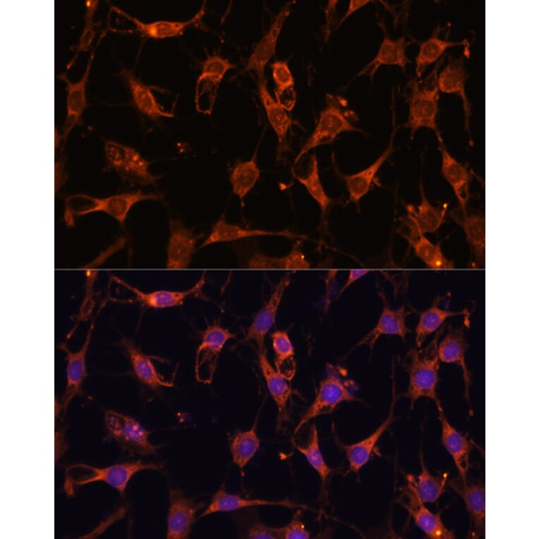 Immunofluorescence - Anti-AKT2 Antibody (A90566) - Antibodies.com