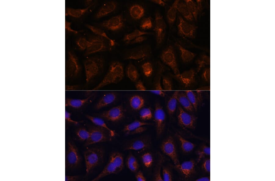 Immunofluorescence - Anti-AKT2 Antibody (A90566) - Antibodies.com