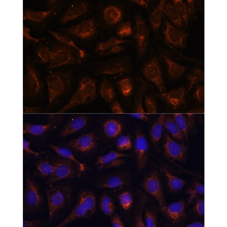 Immunofluorescence - Anti-AKT2 Antibody (A90566) - Antibodies.com