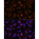 Immunofluorescence - Anti-AKT2 Antibody (A90566) - Antibodies.com