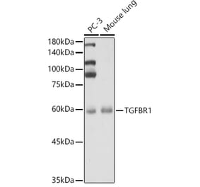 Western Blot - Anti-TGF beta Receptor I Antibody (A90567) - Antibodies.com