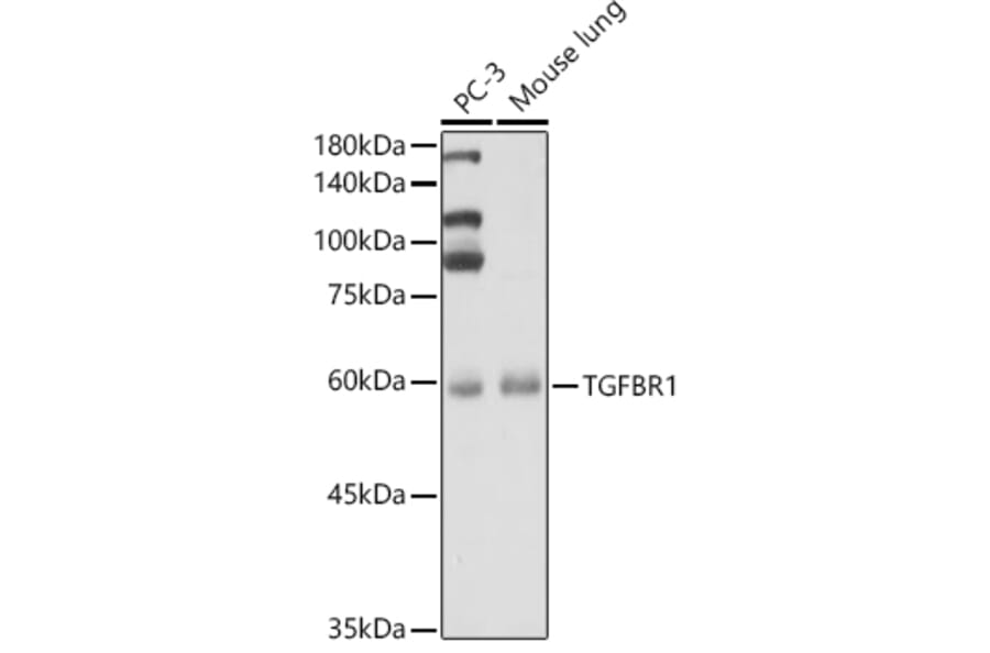 Western Blot - Anti-TGF beta Receptor I Antibody (A90567) - Antibodies.com