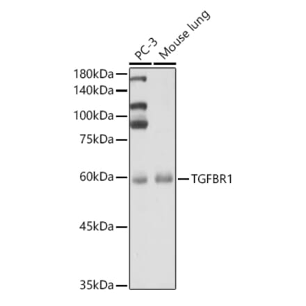 Western Blot - Anti-TGF beta Receptor I Antibody (A90567) - Antibodies.com