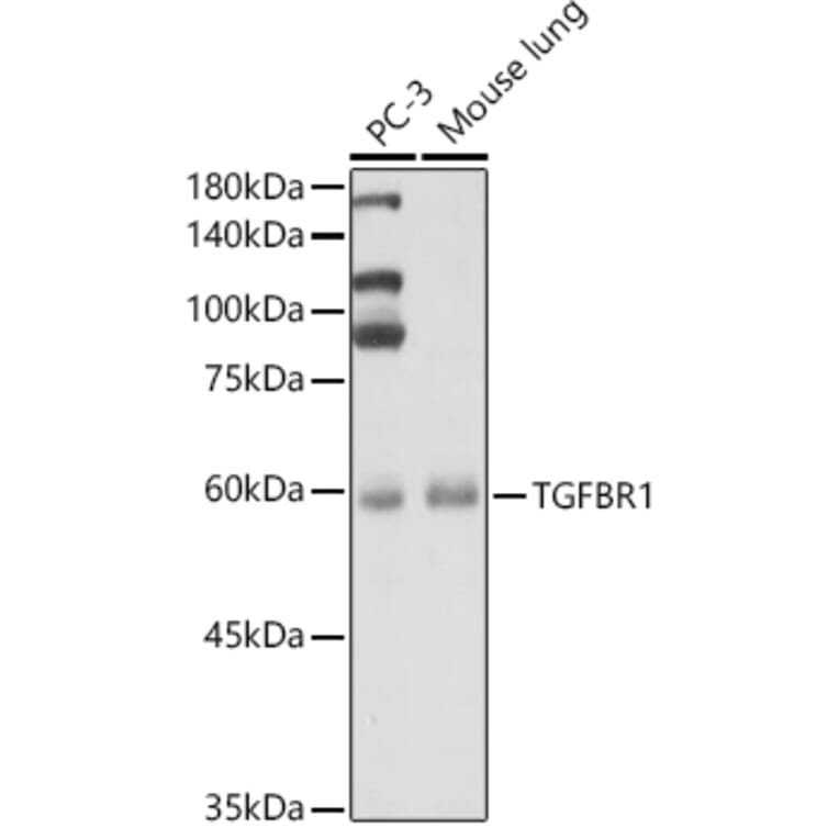 Western Blot - Anti-TGF beta Receptor I Antibody (A90567) - Antibodies.com