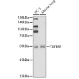 Western Blot - Anti-TGF beta Receptor I Antibody (A90567) - Antibodies.com