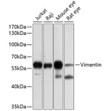 Western Blot - Anti-Vimentin Antibody (A90568) - Antibodies.com