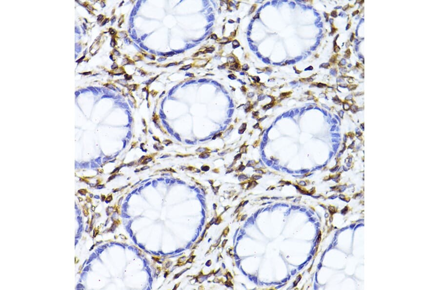 Immunohistochemistry - Anti-Vimentin Antibody (A90568) - Antibodies.com