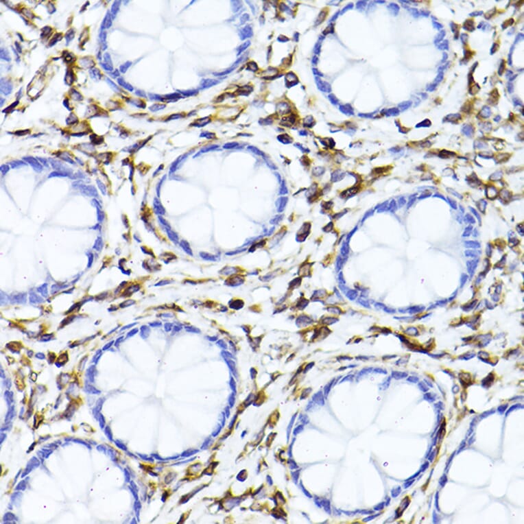 Immunohistochemistry - Anti-Vimentin Antibody (A90568) - Antibodies.com