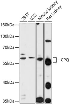 Western blot analysis of extracts of various cell lines, using Anti-CPQ Antibody (A12062) at 1:1,000 dilution.
Secondary antibody: Goat Anti-Rabbit IgG (H+L) (HRP) (AS014) at 1:10,000 dilution.
Lysates / proteins: 25µg per lane.
Blocking buffer: 3% non-fat dry milk in TBST.
Detection: ECL Enhanced Kit (RM00021).
Exposure time: 90s.