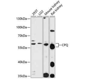 Western Blot - Anti-PGCP Antibody (A90569) - Antibodies.com