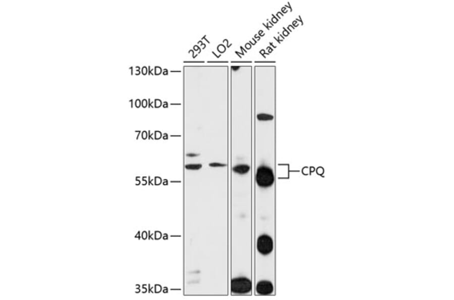 Western Blot - Anti-PGCP Antibody (A90569) - Antibodies.com