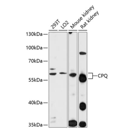 Western Blot - Anti-PGCP Antibody (A90569) - Antibodies.com