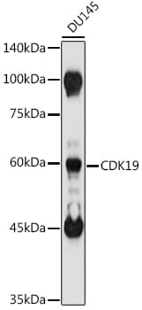 Western blot analysis of extracts of various cell lines, using Anti-CDK19 Antibody (A16109) at 1:1,000 dilution.
Secondary antibody: Goat Anti-Rabbit IgG (H+L) (HRP) (AS014) at 1:10,000 dilution.
Lysates / proteins: 25µg per lane.
Blocking buffer: 3% non-fat dry milk in TBST.
Detection: ECL Basic Kit (RM00020).
Exposure time: 60s.