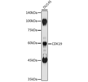 Western Blot - Anti-CDC2L6 Antibody (A90570) - Antibodies.com