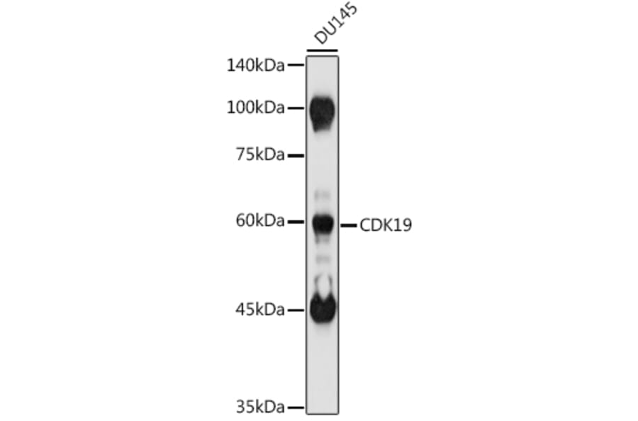 Western Blot - Anti-CDC2L6 Antibody (A90570) - Antibodies.com